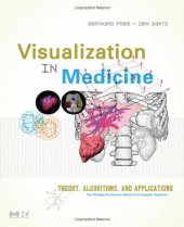 book Visualization in medicine. Theory, algorithms, and applications