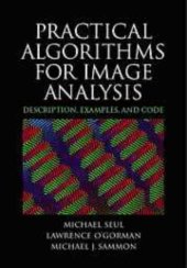 book Practical algorithms for image analysis: description, examples, and code