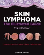 book Skin Lymphoma: The Illustrated Guide, Third Edition