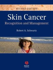 book Skin Cancer: Recognition and Management, Second Edition