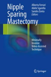 book Nipple Sparing Mastectomy: Minimally Invasive Video-Assisted Technique