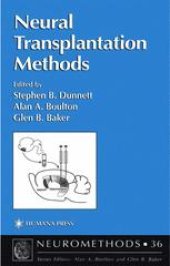 book Neural Transplantation Methods