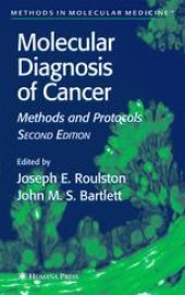 book Molecular Diagnosis of Cancer: Methods and Protocols