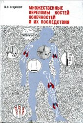 book Множественные переломы костей конечностей и их последствия