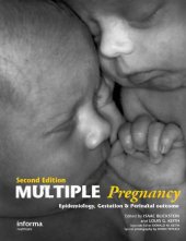 book Multiple pregnancy