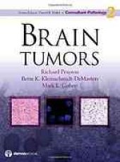 book Brain tumors