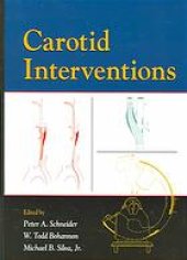 book Carotid interventions