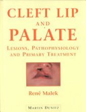 book Cleft Lip and Palate: Lesions, Pathophysiology and Primary Treatment