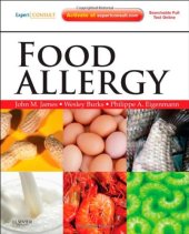 book Food Allergy: Expert Consult Basic