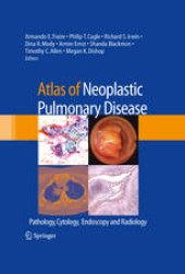 book Atlas of Neoplastic Pulmonary Disease: Pathology, Cytology, Endoscopy and Radiology