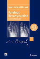 book Forefoot Reconstruction