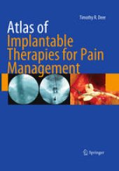 book Atlas of Implantable Therapies for Pain Management