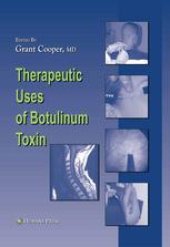 book Therapeutic Uses of Botulinum Toxin