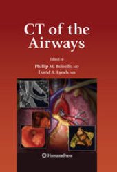 book CT of the Airways