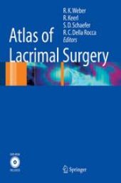 book Atlas of Lacrimal Surgery