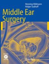 book Middle Ear Surgery