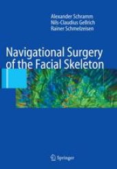 book Navigational Surgery of the Facial Skeleton