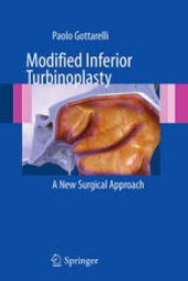 book Modified Inferior Turbinoplasty: A New Surgical Approach