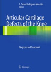 book Articular Cartilage Defects of the Knee: Diagnosis and Treatment