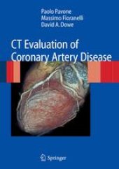 book CT Evaluation of Coronary Artery Disease