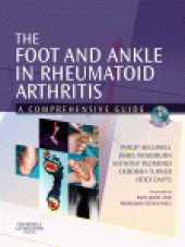 book The Foot and Ankle in Rheumatoid Arthritis. A Comprehensive Guide