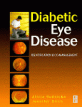 book Diabetic Eye Disease. Identification and co-management