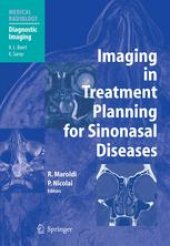 book Imaging in Treatment Planning for Sinonasal Diseases