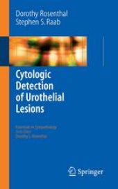 book Cytologic Detection of Urothelial Lesions