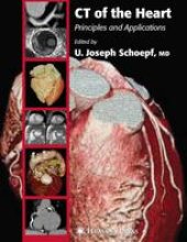 book CT of the Heart: Principles and Applications