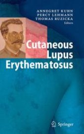 book Cutaneous Lupus Erythematosus