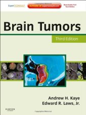 book Brain Tumors: An Encyclopedic Approach, Expert Consult -  Online and Print, 3e