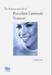 book Science and Art of Porcelain Laminate Veneers