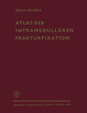 book Atlas der Intramedullären Frakturfixation nach Rush: Ein Behandlungssystem