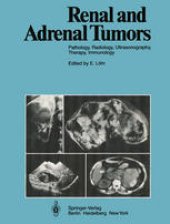 book Renal and Adrenal Tumors: Pathology, Radiology, Ultrasonography, Therapy, Immunology