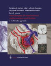 book Neurosurgery of Arteriovenous Malformations and Fistulas: A Multimodal Approach