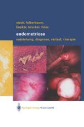 book Endometriose: Entstehung, Diagnose, Verlauf und Therapie