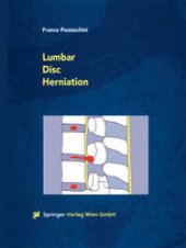 book Lumbar Disc Herniation