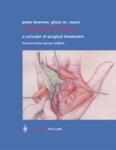 book Dupuytren’s Disease: A Concept of Surgical Treatment