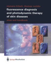 book Fluorescence Diagnosis and Photodynamic Therapy of Skin Diseases: Atlas and Handbook