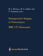 book Intraoperative Imaging in Neurosurgery: MRI, CT, Ultrasound