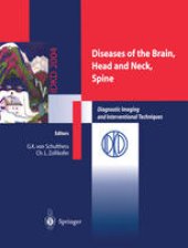 book Diseases of the Brain, Head and Neck, Spine: Diagnostic Imaging and Interventional Techniques