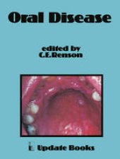 book Oral Disease