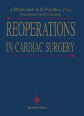 book Reoperations in Cardiac Surgery