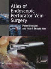 book Atlas of Endoscopic Perforator Vein Surgery