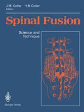 book Spinal Fusion: Science and Technique