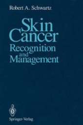 book Skin Cancer: Recognition and Management