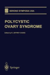 book Polycystic Ovary Syndrome