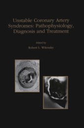 book Unstable Coronary Artery Syndromes Pathophysiology, Diagnosis and Treatment