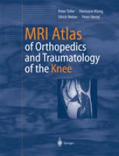 book MRI Atlas of Orthopedics and Traumatology of the Knee