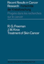 book Treatment of Skin Cancer